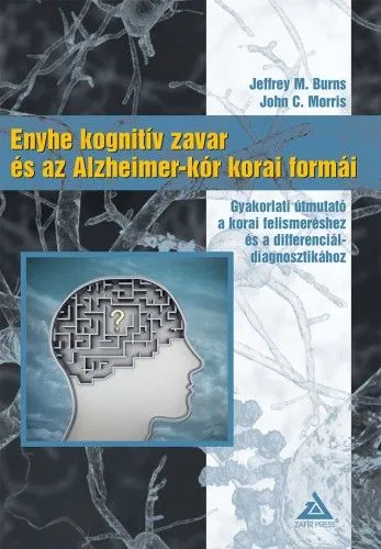 Enyhe kognitív zavar és az Alzheimer-kór korai formái Utolsó esély