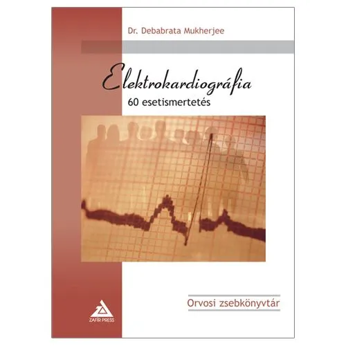 Különleges ajánlat Elektrokardiográfia - 60 esetismertetés